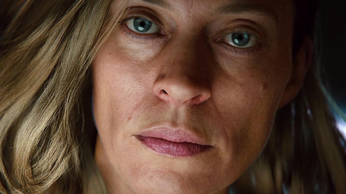 Skin dual Lobe and diffuse power image